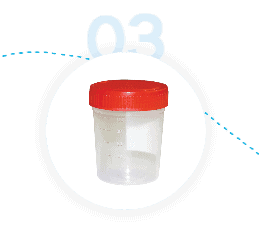 Tick-Borne Disease Urine Testing - Step 3 - Collect Urine Sample at Home
